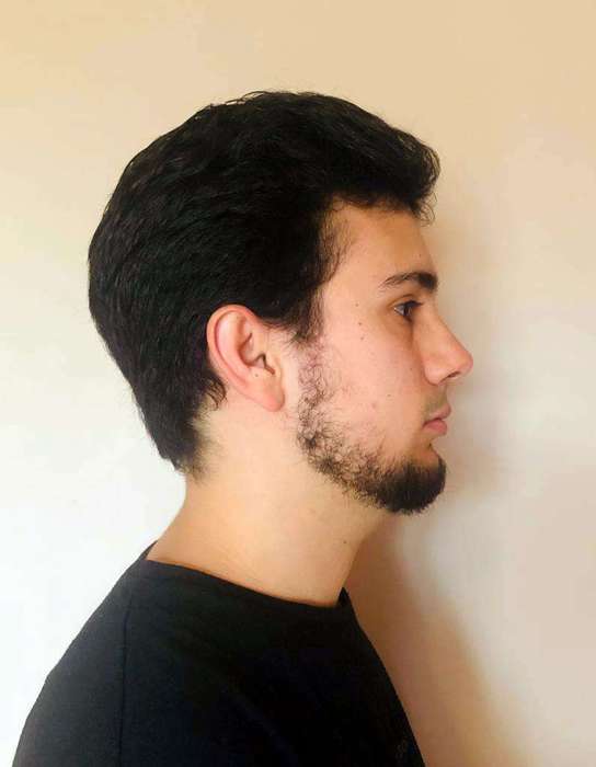 Remote Orthodontic Consultations Dublin Orthodontics